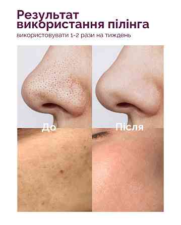 Пілінг-скатка для обличчя і тіла Reclaire cosmetics 50 мл Київ