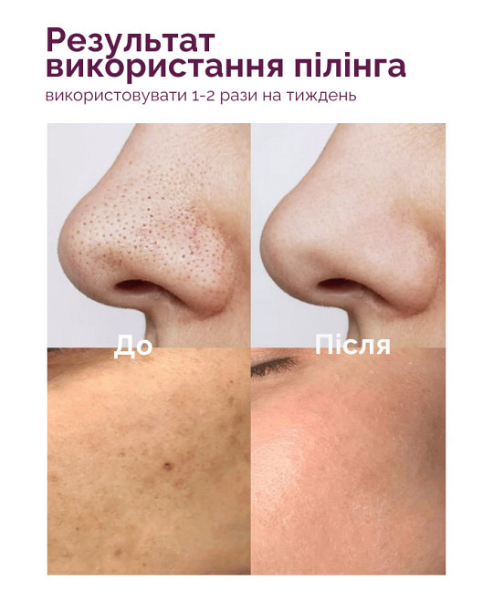 Пилинг-скатка для лица и тела Reclaire cosmetics 50 мл Киев - изображение 5