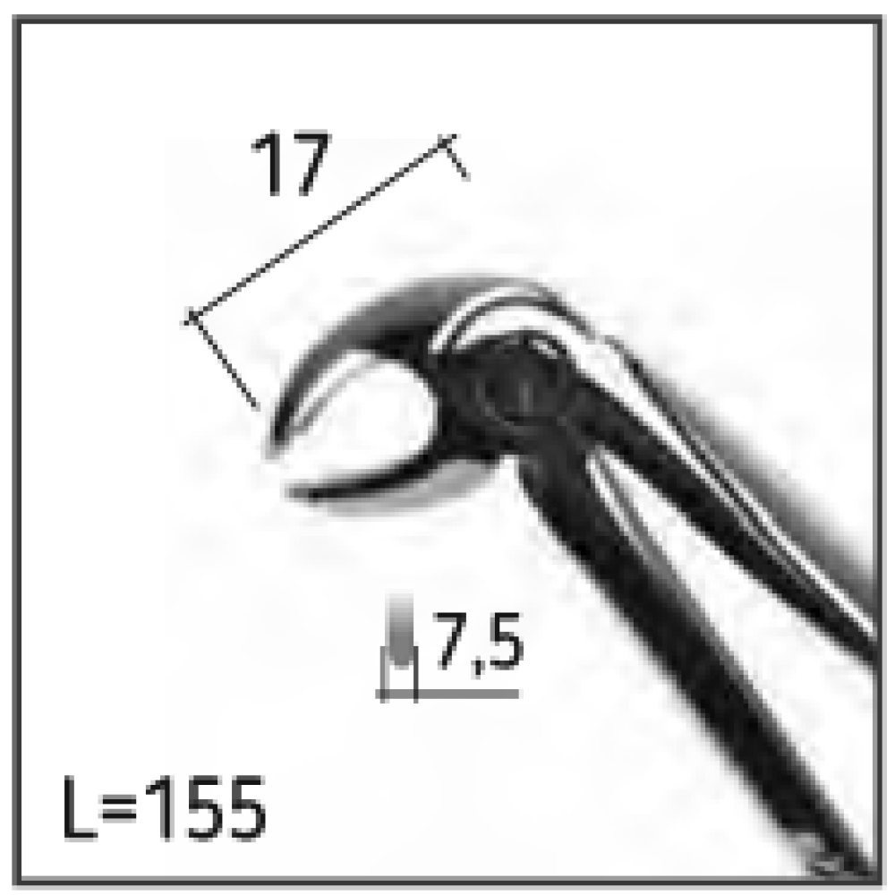 Экстракционные щипцы U.K 22 N0951 Днепр - изображение 2