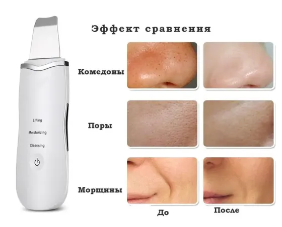 Аппарат для ультразвуковой чистки лица Ultrasonic Shovel Коломия