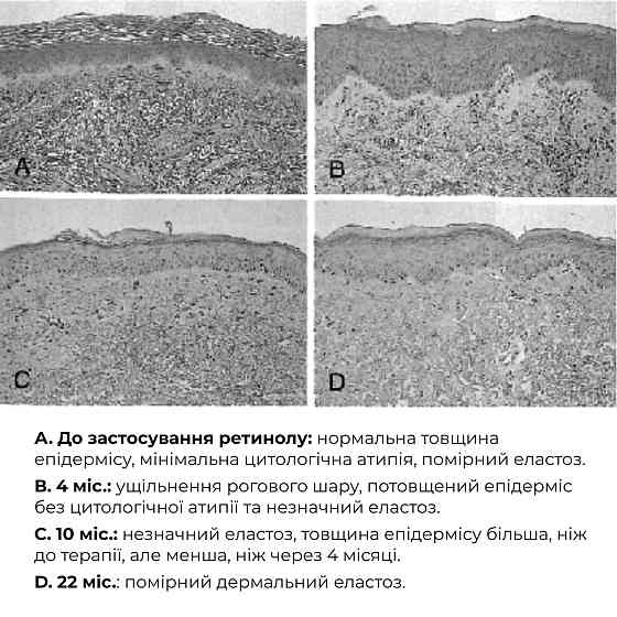 Комплекс ночного обновления кожи лица с ретинолом и пептидами. ReNuAge Nighttime Skin Renewal Complex with Retinol and Peptides Hillary Киев
