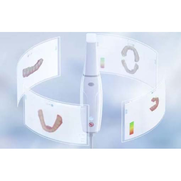 Інтраоральний сканер Smile Scan Дніпро - фото 3