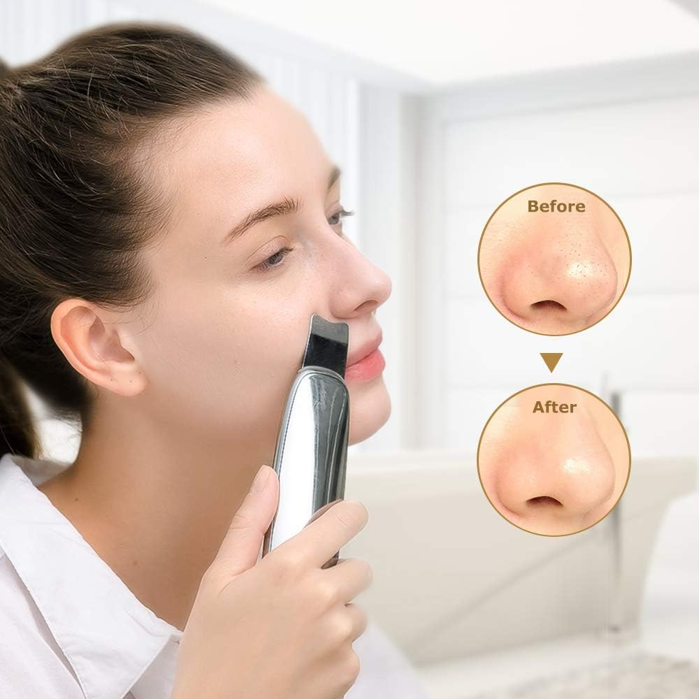 Ультразвуковий скрабер для обличчя TOUCHBeauty Ultrasonic Scrub Device TB-1769 професійний апарат для пілінгу та ліфтингу срібляст Київ - фото 6