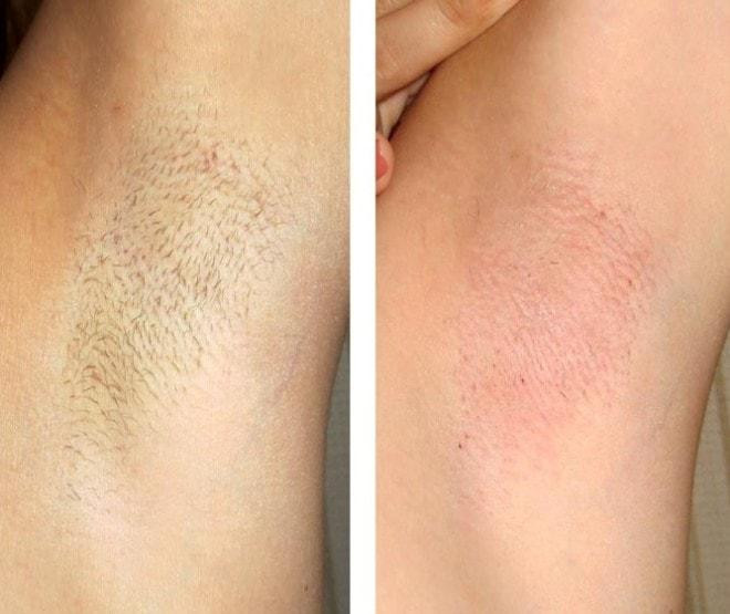 Гранули для епіляції Hillary Epilage Premium Gold, 100 г Київ - фото 9