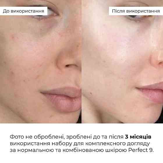 Набір для комплексного догляду за нормальною та комбінованою шкірою Hillary Perfect 9 Київ