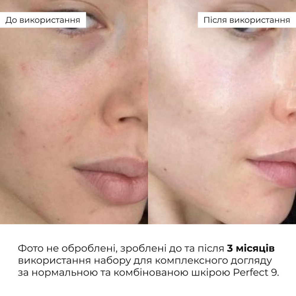 Набір для комплексного догляду за нормальною та комбінованою шкірою Hillary Perfect 9 Київ - фото 2