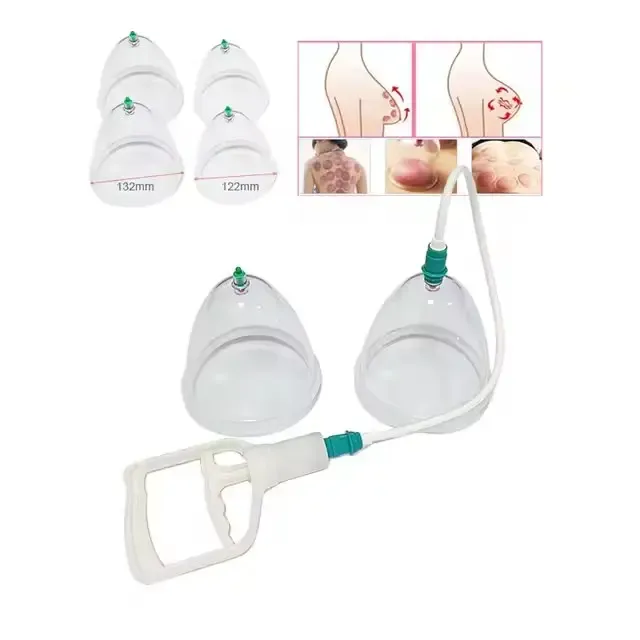 Вакуумные банки для увеличения груди с насосом YUEXIAO Коломыя - изображение 5