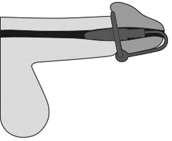 Стимулятор уретры - Penis Plug + Silicone Glans Ring Dilator Sex Aura Киев