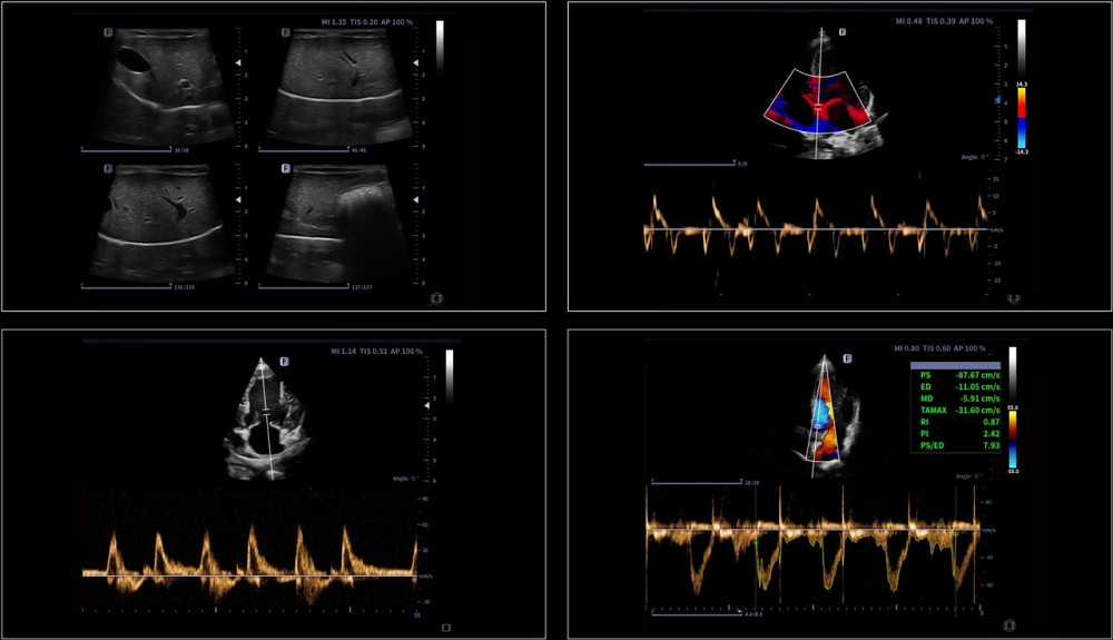 Lynus 5P ветеринарна портативна ультразвукова діагностична система +2 датчика Focus&Fusion Дніпро - фото 4