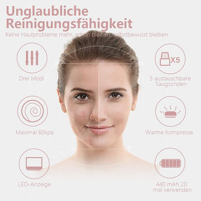 Вакуумний очищувач пор Mosen з LED-дисплеєм, домашній прилад для видалення чорних крапок, 5 насадок, Київ - фото 6