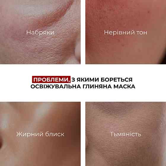 Комплекс для борьбы с отеками и тусклости кожи Hillary Anti-Puffiness & Dullness Skin Care Complex Киев