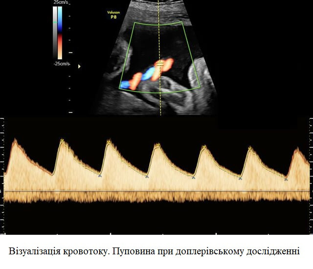 Ультразвуковой аппарат (УЗИ) Voluson™ P8 Днепр - изображение 5