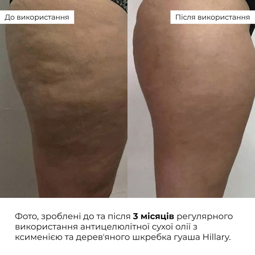 Комплекс для упругого тела и энергии с протеиновой гранолой Hillary Firm Body & Energy Set with Protein Granola Gregory Mill Киев - изображение 2