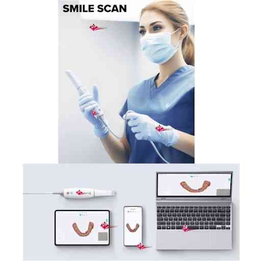 Інтраоральний сканер Smile Scan Дніпро