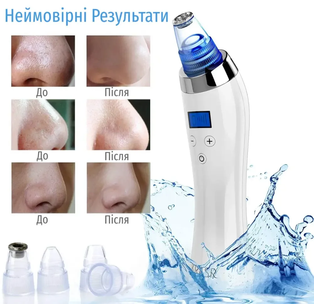 Вакуумный очиститель пор KRASR Comedo Suction, аппарат для микродермабразии и удаления черных точек (5 уровней) Киев - изображение 5