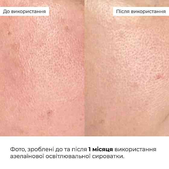 Комплекс для сяйва й захисту шкіри SPF50 Hillary Brightening and Skin Protection Complex Київ