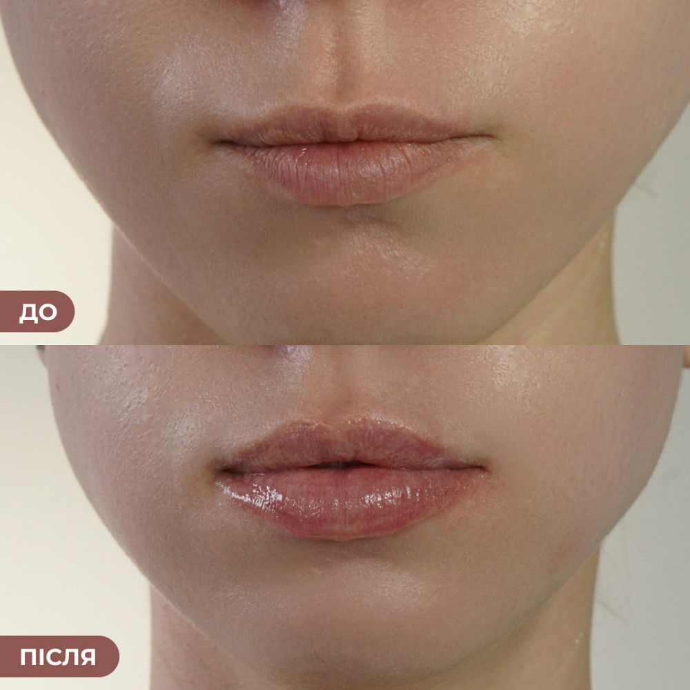Набір проти сухості та для об’єму губ Hillary Lip Hydration & Plumping Set Київ - фото 4
