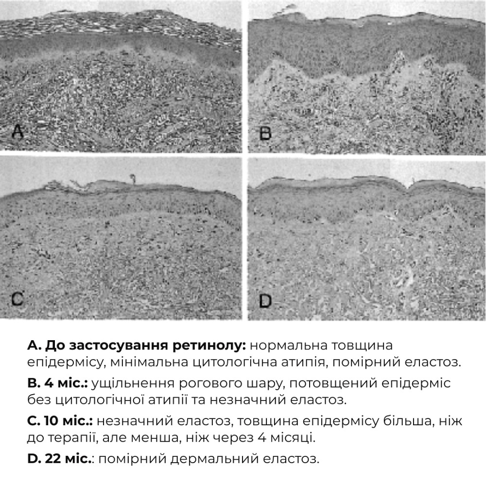Набор антивозрастных сывороток с экзосомами и ретинолом ReNuAge Day & Night Anti-Aging Serums Hillary Киев - изображение 15