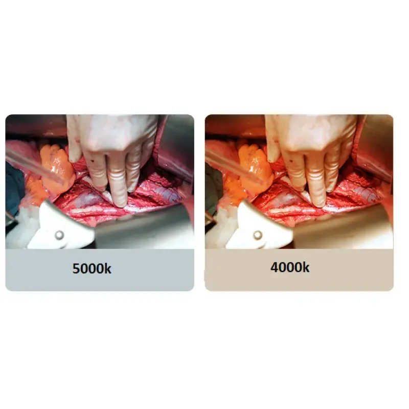 Операційна лампа Wellman WL700-700 двокупольна Дніпро - фото 5