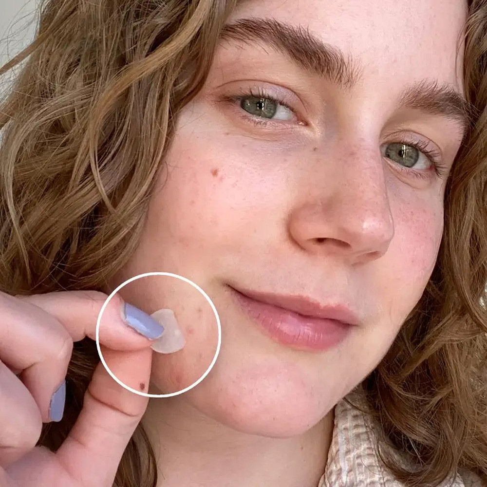 Пластир від папілом та бородавок,30 шт. SBR Київ - фото 6