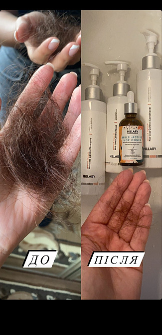 Набір проти випадіння волосся + Мезороллер для шкіри голови Hillary Київ - фото 14