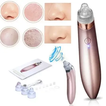 Аппарат для вакуумной чистки лица XN-8030 Коломыя