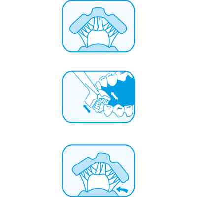 Детская зубная щетка Dr. Barman's Superbrush (Dentaco AG), 9603210000, тристороння (від 0-6 років), фіолетова (8.121/7) Винница