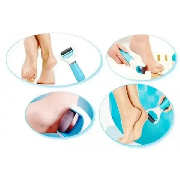 Пилка электрическая для ног с USB  или от батареек 4АА, без острых лезвий, для сухой кожи стоп Одесса - изображение 5