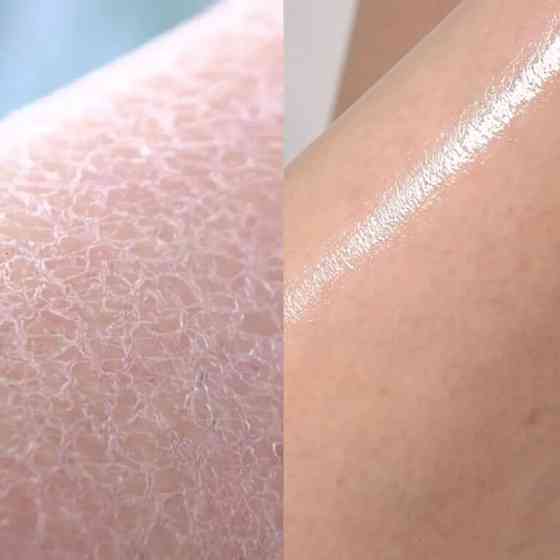 Протизапальний гель для душу з кислотами Red Acne Body Wash 2.0 Medicube 400 г Київ