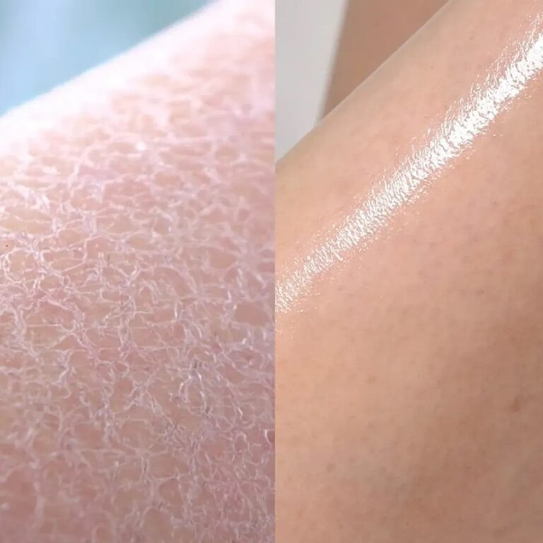 Противовоспалительный гель для душа с кислотами Red Acne Body Wash 2.0 Medicube 400 мл Киев - изображение 2