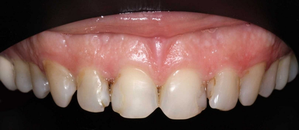 Объектив Стоматология, Природа Canon EF 100mm. F/2.8L Macro IS USM Киев - изображение 3