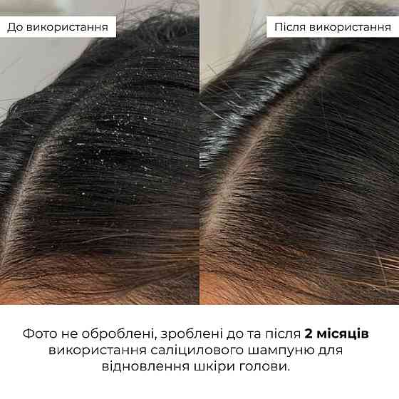 Комплекс для глибокого очищення та відновлення волосся і шкіри голови з термозахистом Hillary Deep Cleanse & Hair Restoration Set Київ