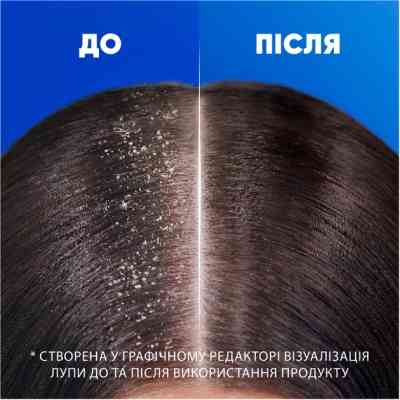 Шампунь Head &amp; Shoulders Для чутливої шкіри 400 мл (5011321336124) Вінниця