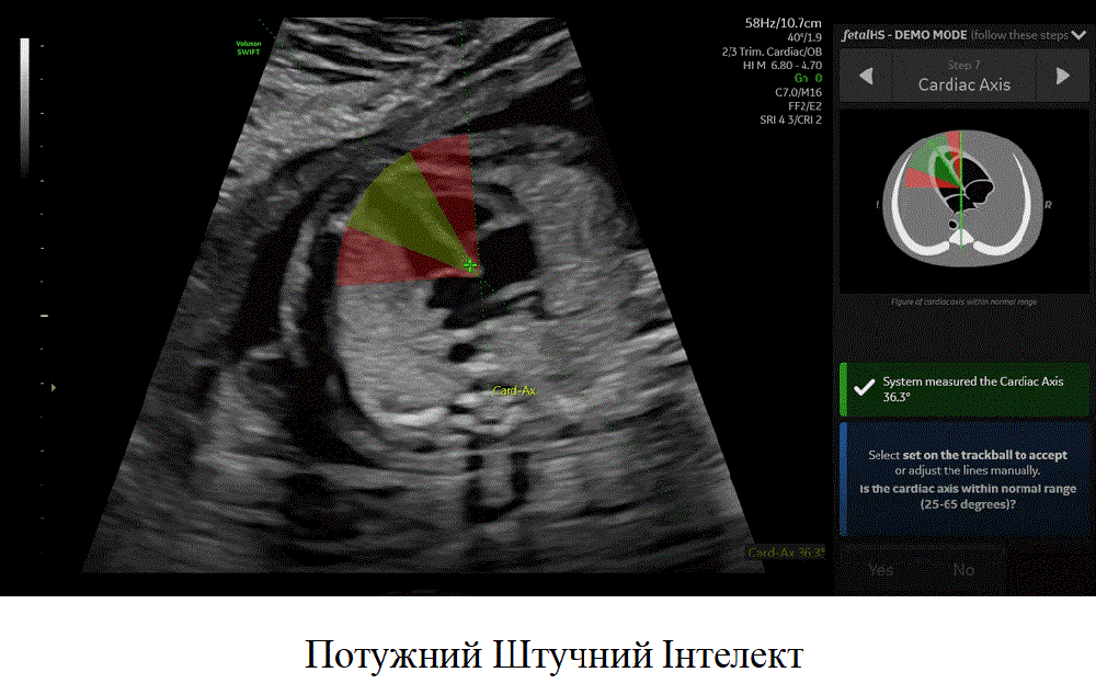 Ультразвуковий апарат (УЗД) Voluson™ SWIFT Дніпро - фото 2