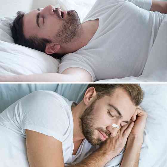 Магнитный расширитель для носа от храпа,30 штук,Белый SBR Киев