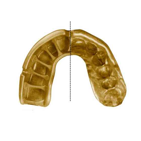 Капа OPRO Gold доросла (вік 11+)  Grillz Black/Gold (art.102504012) Луцк