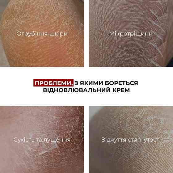 Відновлювальний крем для сухої і потрісканої шкіри ніг HydraHeel Urea & Lanolin Repair Cream Hillary 100 мл Київ