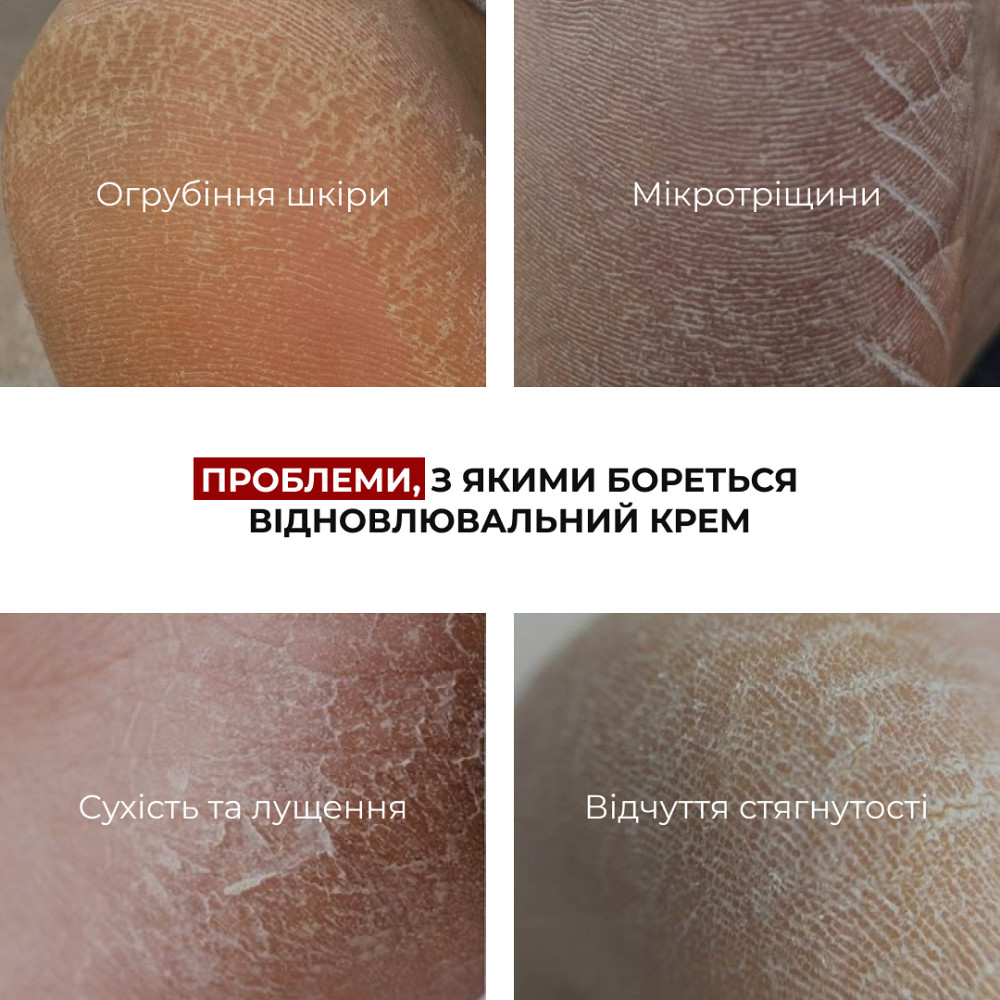 Восстанавливающий крем для сухой и потрескавшейся кожи ног HydraHeel Urea & Lanolin Repair Cream Hillary 100 мл Киев - изображение 5