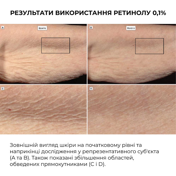 Сыворотка для активного восстановления кожи ReNuAge Retinol Active Renewal Serum Hillary 30 мл Винница - изображение 12