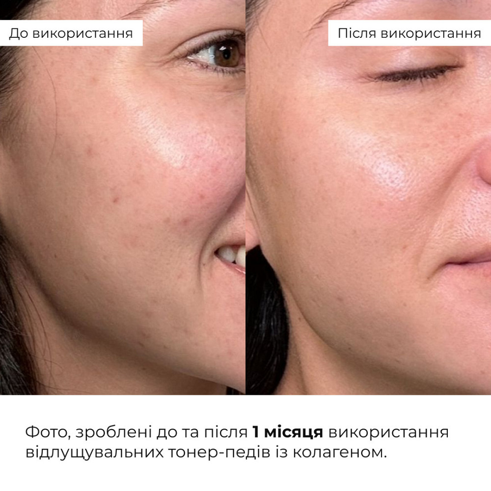 Комплекс пептидного омоложения и коррекции морщин Hillary Collagen & Peptide Anti-Age & Wrinkle Correction Set Киев - изображение 6