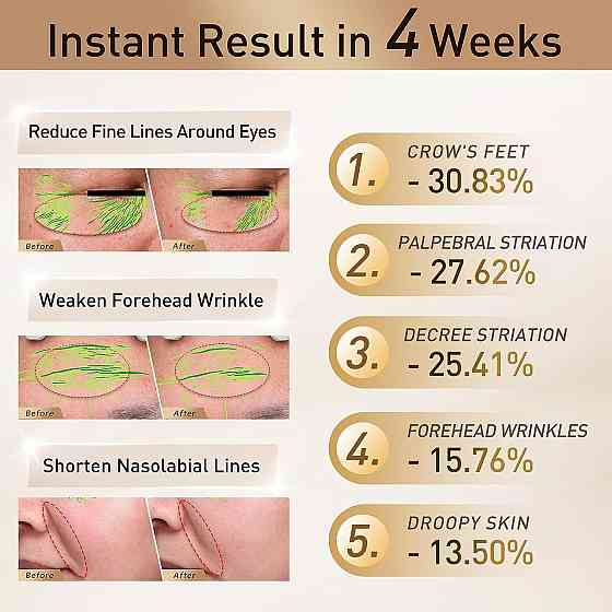 Масажер для обличчя FLOSSOM RF + SkinLifting Преміум апарат мікрострумової та радіохвильової терапії з червоним світлом Київ