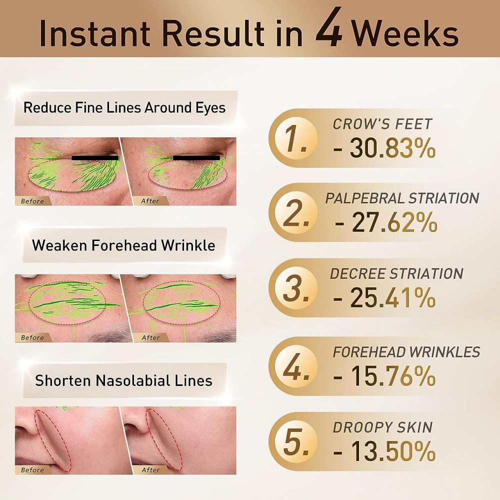 Масажер для обличчя FLOSSOM RF + SkinLifting Преміум апарат мікрострумової та радіохвильової терапії з червоним світлом Київ - фото 6