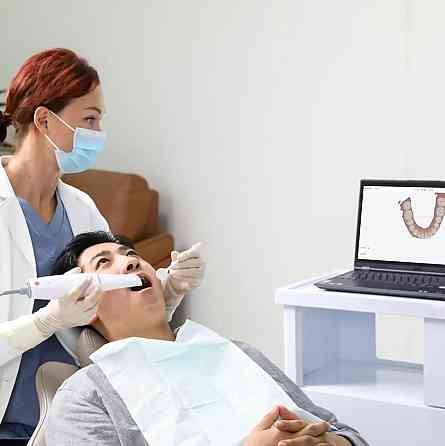 Інтраоральний сканер Smile Scan Дніпро