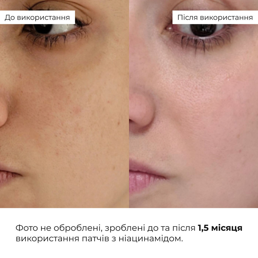 Набір для корекції темних кіл та подразнень Hillary Dark Circles & Irritation Correction Set Київ - фото 9