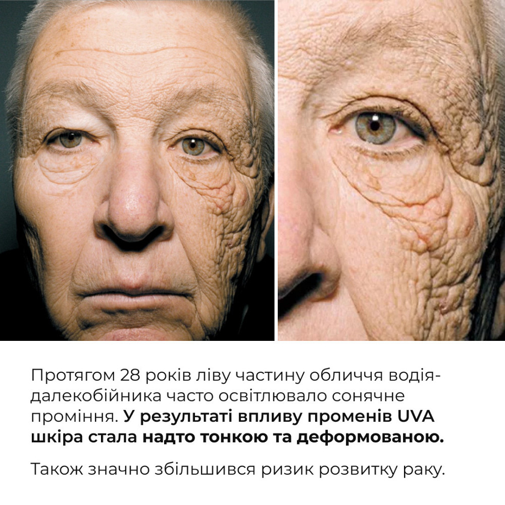 Набор для защиты кожи лица и тела от фотостарения SPF 50+ Hillary Face & Body Photoaging Defense Set Киев - изображение 7