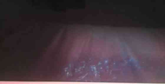 Телевизор Безрамный: 65