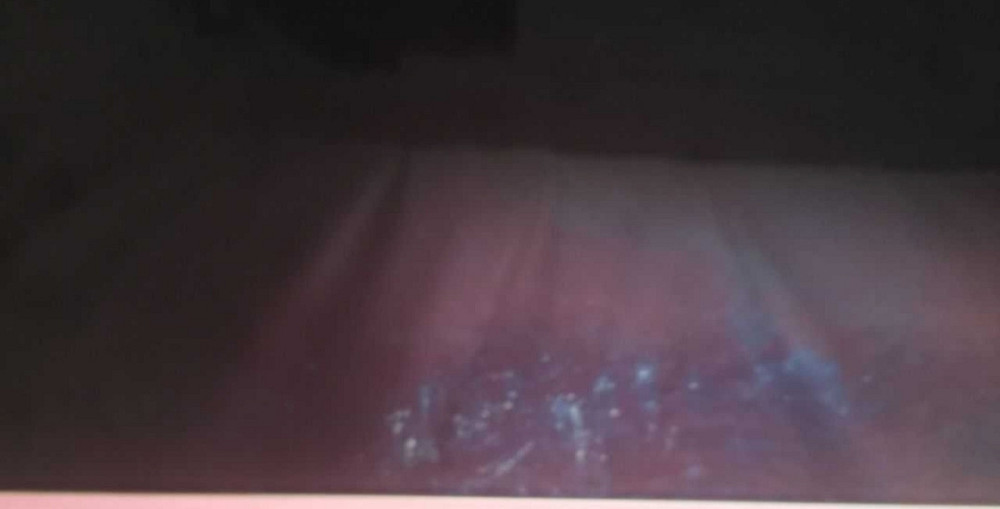 Телевизор Безрамный: 65