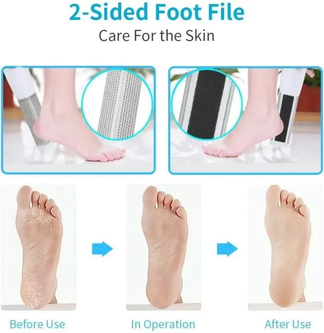 Набор инструментов для педикюра (Станок, терка, триммер, кусачки + 10 лезвий) Киев - изображение 5