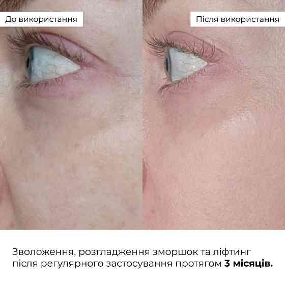 Антивозрастной базовый уход для лица Hillary Basic Anti-Aging Care Киев