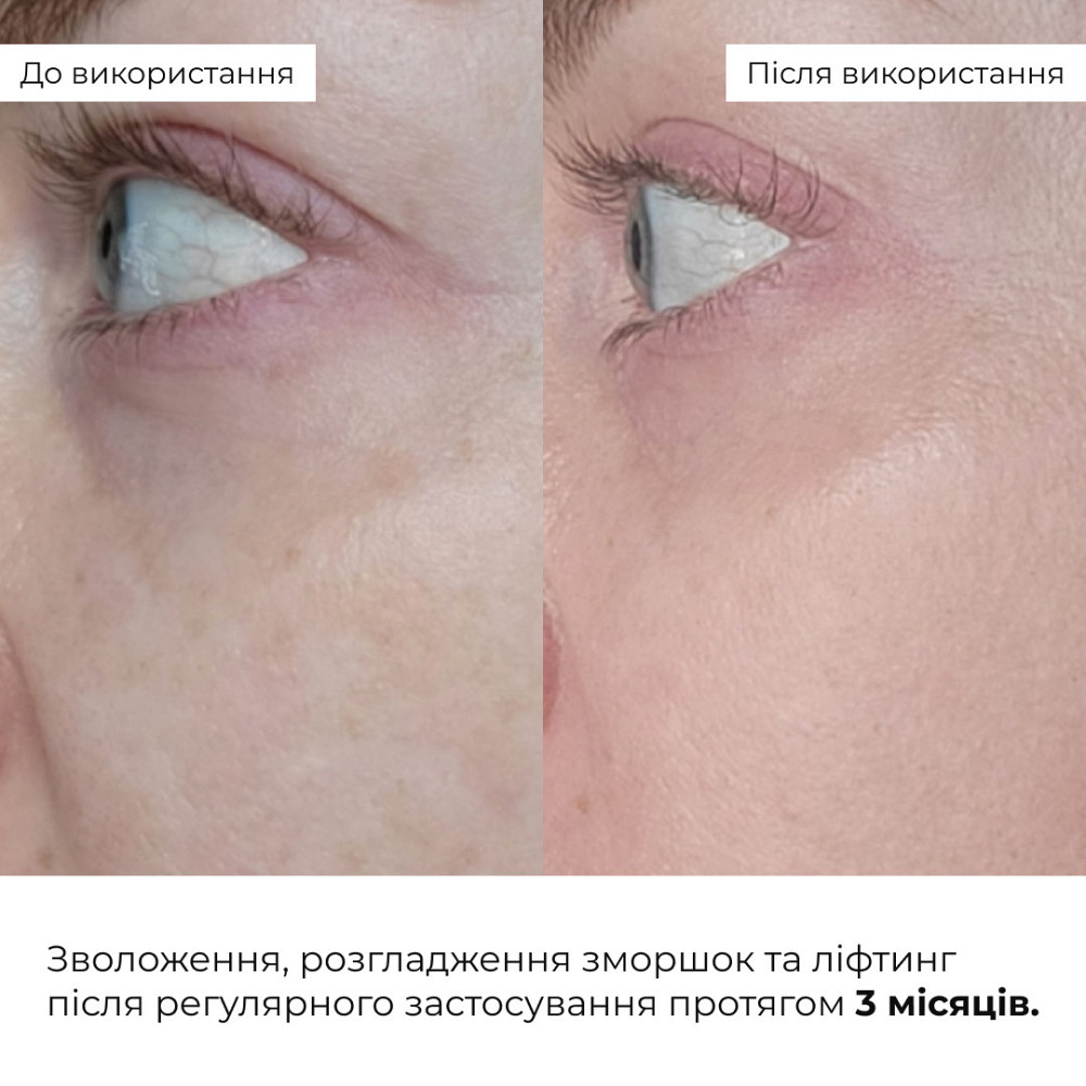 Антивозрастной базовый уход для лица Hillary Basic Anti-Aging Care Киев - изображение 2